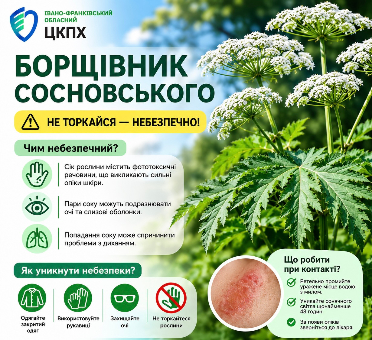 Борщівник Сосновського: небезпечний «гігант» поруч із нами.